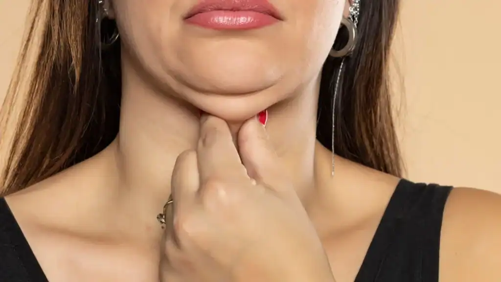 An image of a woman with double chin, sad, worried : Non Surgical Double Chin Removal Treatment in Springs Mire, UK