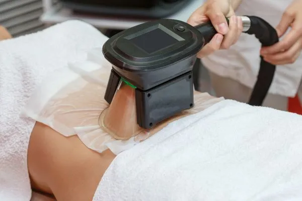 Image of person having fat freezing treatment to help weight gain Springs Mire