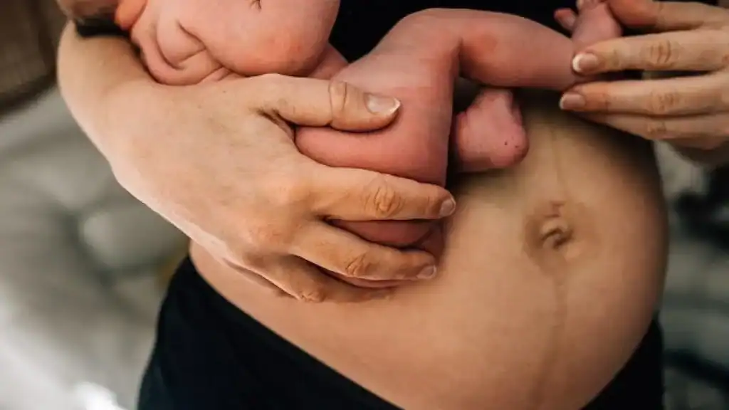 Why Is My Stomach Still Big After Pregnancy Springs Mire?